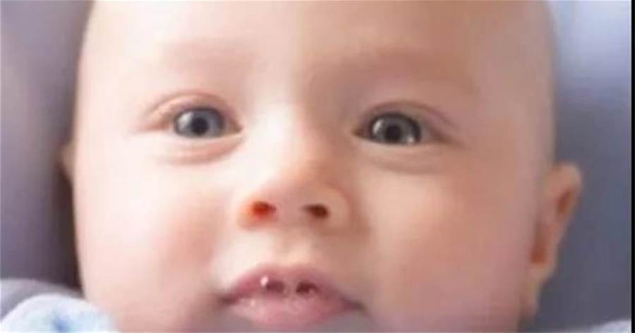 新生兒吐泡泡是肺炎嗎？如何區分？